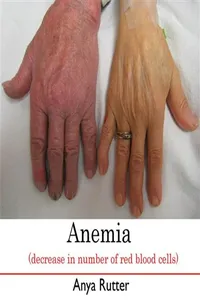Anemia_cover