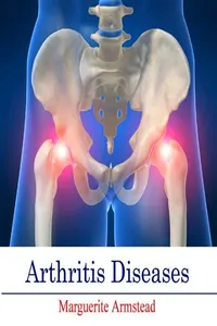 Arthritis Diseases_cover