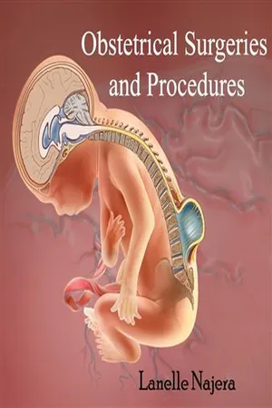 Obstetrical Surgeries and Procedures