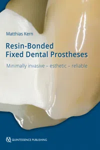 Resin-Bonded Fixed Dental Prostheses_cover