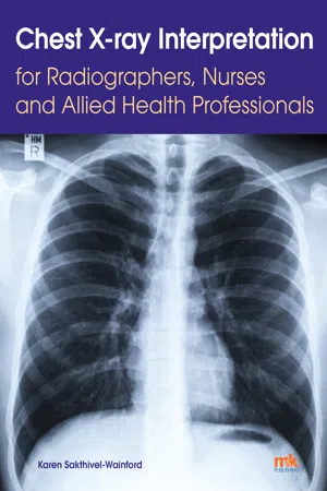Chest X-ray Interpretation for Radiographers, Nurses and Allied Health Professionals