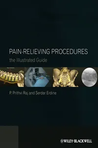 Pain-Relieving Procedures_cover