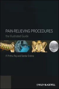 Pain-Relieving Procedures_cover