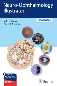 Neuro-Ophthalmology Illustrated_cover