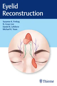 Eyelid Reconstruction_cover