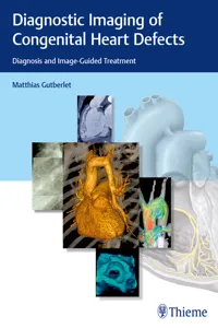 Diagnostic Imaging of Congenital Heart Defects_cover