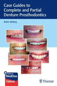 Case Guides to Complete and Partial Denture Prosthodontics_cover