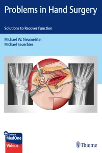 Problems in Hand Surgery_cover
