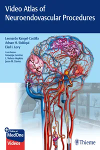 Video Atlas of Neuroendovascular Procedures_cover