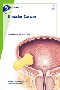Fast Facts: Bladder Cancer_cover