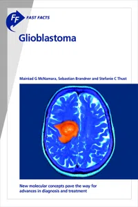Fast Facts: Glioblastoma_cover