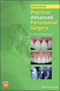 Practical Advanced Periodontal Surgery_cover