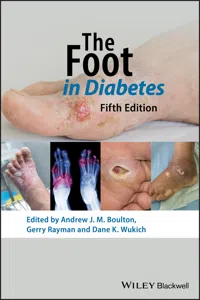 The Foot in Diabetes_cover
