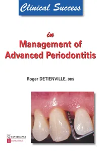 Clinical Success in Management of Advanced Periodontitis_cover