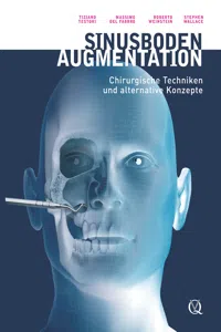 Sinusbodenaugmentation_cover