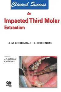 Clinical Success in Impacted Third Molar Extraction_cover