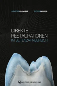 Direkte Restaurationen im Seitenzahnbereich_cover