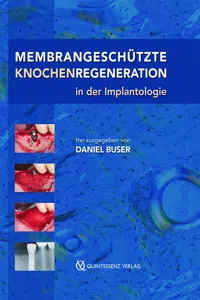 Membrangeschützte Knochenregeneration in der Implantologie_cover