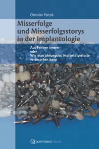 Misserfolge und Misserfolgsstorys in der Implantologie_cover