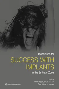 Techniques for Success With Implants in the Esthetic Zone_cover