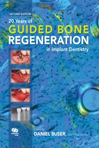 20 Years of Guided Bone Regeneration in Implant Dentistry_cover