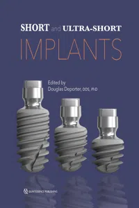 Short and Ultra-Short Implants_cover
