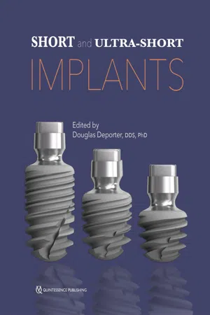 Short and Ultra-Short Implants