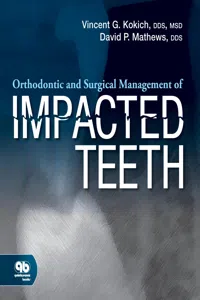 Orthodontic and Surgical Management of Impacted Teeth_cover