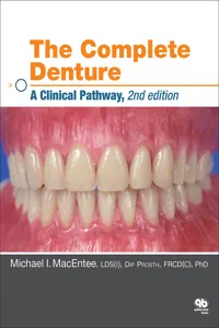 The Complete Denture_cover