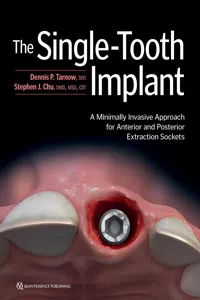 The Single-Tooth Implant:_cover