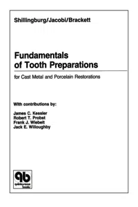 Fundamentals of Tooth Preparations for Cast Metal and Porcelain Restorations_cover