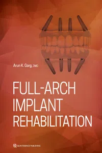 Full-Arch Implant Rehabilitation_cover