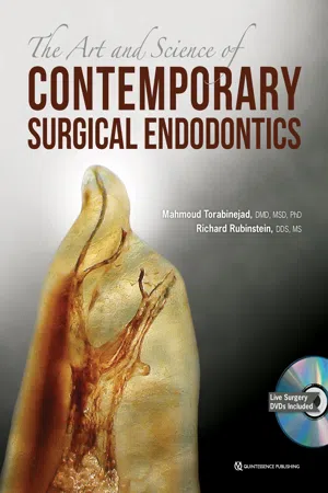 The Art and Science of Contemporary Surgical Endodontics