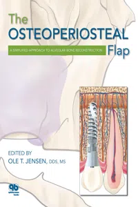The Osteoperiosteal Flap_cover