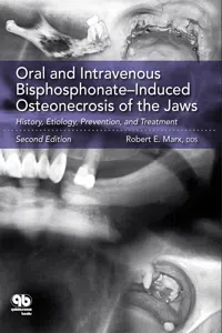 Oral and Intravenous Bisphosphonate–Induced Osteonecrosis of the Jaws_cover