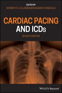 Cardiac Pacing and ICDs_cover