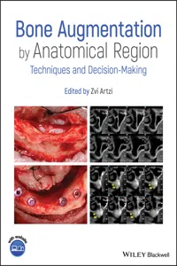 Bone Augmentation by Anatomical Region_cover