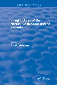 Imaging Atlas of the Normal Gallbladder and Its Variants_cover