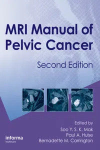 MRI Manual of Pelvic Cancer_cover