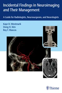 Incidental Findings in Neuroimaging and Their Management_cover