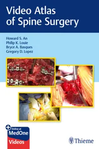 Video Atlas of Spine Surgery_cover