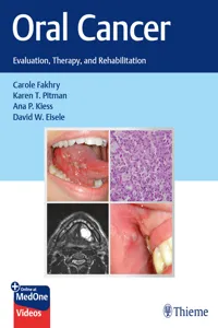 Oral Cancer_cover