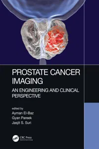 Prostate Cancer Imaging_cover
