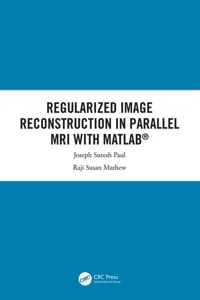Regularized Image Reconstruction in Parallel MRI with MATLAB_cover