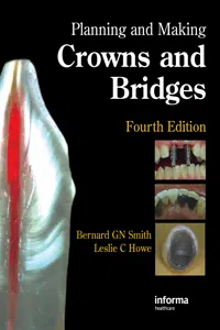 Planning and Making Crowns and Bridges_cover