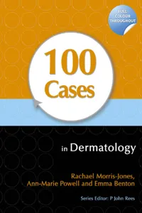 100 Cases in Dermatology_cover