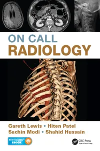 On Call Radiology_cover