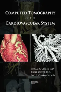 Computed Tomography of the Cardiovascular System_cover