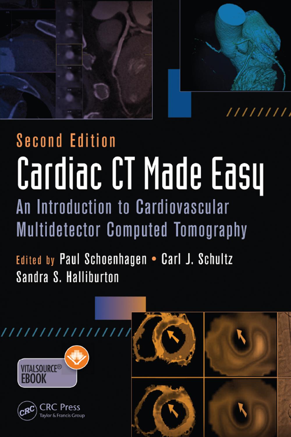 PDF] Cardiac CT Made Easy by Paul Schoenhagen MD FAHA, 2nd edition