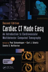 Cardiac CT Made Easy_cover